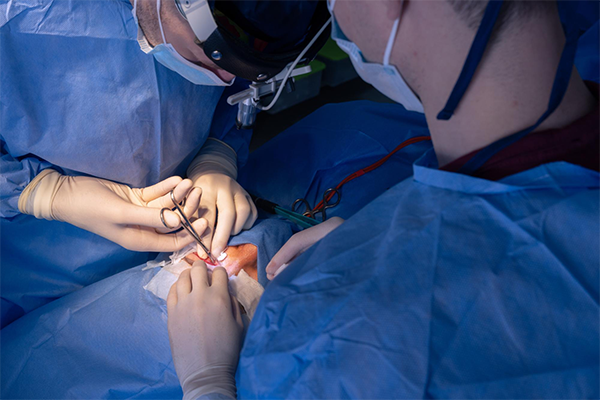 Laparoscopic myomectomy: Fibroid removal surgery explained 